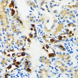 Anti-GABARAP antibody used in IHC (Paraffin sections) (IHC-P). GTX64449