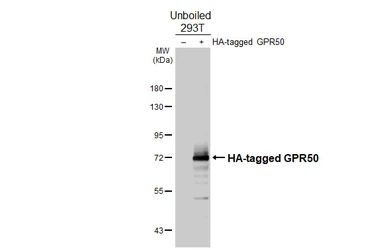 Anti-GPR50 antibody [HL4628] used in Western Blot (WB). GTX644492