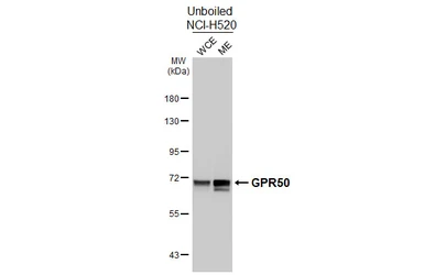 Anti-GPR50 antibody [HL4628] used in Western Blot (WB). GTX644492