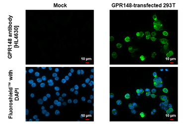 Anti-GPR148 antibody [HL4630] used in Immunocytochemistry/ Immunofluorescence (ICC/IF). GTX644494