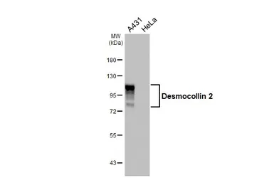 Anti-Desmocollin 2 antibody [HL4655] used in Western Blot (WB). GTX644508