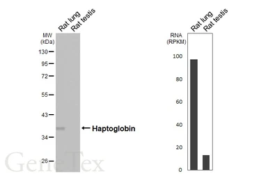 Anti-Haptoglobin antibody [HL4637] used in Western Blot (WB). GTX644510
