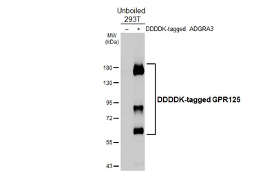 Anti-GPR125 antibody [HL4659] used in Western Blot (WB). GTX644532