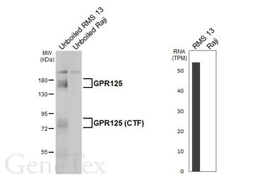 Anti-GPR125 antibody [HL4659] used in Western Blot (WB). GTX644532