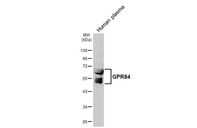 Anti-GPR84 antibody [HL4667] used in Western Blot (WB). GTX644540