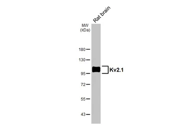 Anti-Kv2.1 antibody [GT260] used in Western Blot (WB). GTX644550