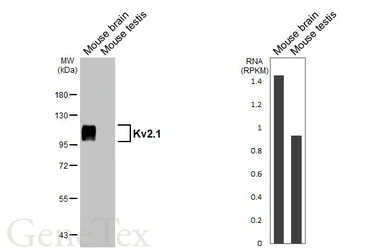 Anti-Kv2.1 antibody [GT260] used in Western Blot (WB). GTX644550