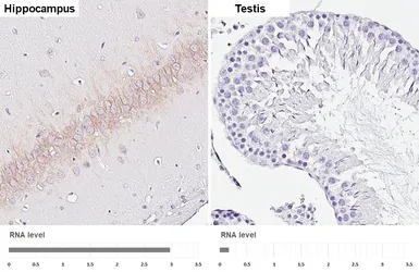 Anti-Kv2.1 antibody [GT260] used in IHC (Paraffin sections) (IHC-P). GTX644550