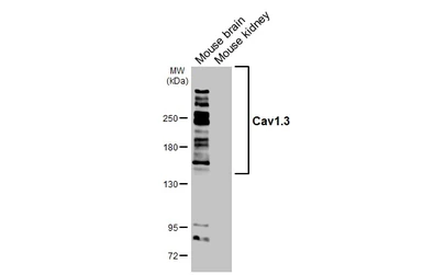 Anti-Cav1.3 antibody [GT265] used in Western Blot (WB). GTX644551