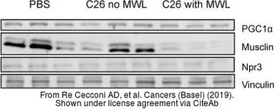 Anti-NPR-C antibody used in Western Blot (WB). GTX64458