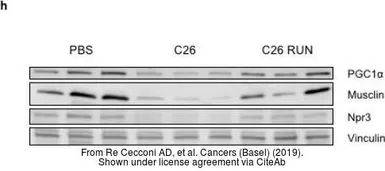 Anti-NPR-C antibody used in Western Blot (WB). GTX64458