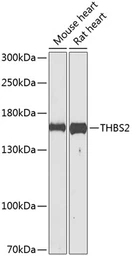 Anti-Thrombospondin 2 antibody used in Western Blot (WB). GTX64459