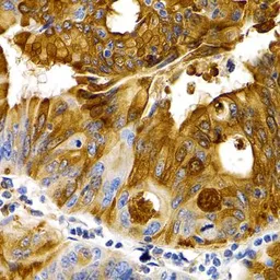 Anti-TFF1 antibody used in IHC (Paraffin sections) (IHC-P). GTX64461
