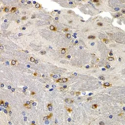 Anti-TFF1 antibody used in IHC (Paraffin sections) (IHC-P). GTX64461