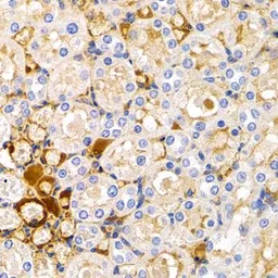 Anti-TFF1 antibody used in IHC (Paraffin sections) (IHC-P). GTX64461