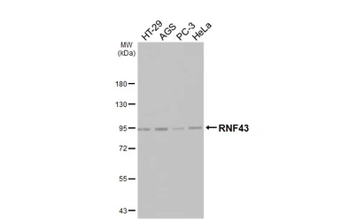 Anti-RNF43 antibody [HL4684] used in Western Blot (WB). GTX644685