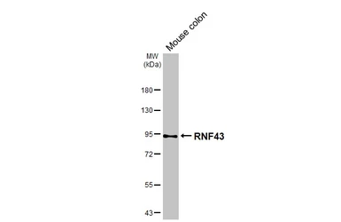 Anti-RNF43 antibody [HL4684] used in Western Blot (WB). GTX644685
