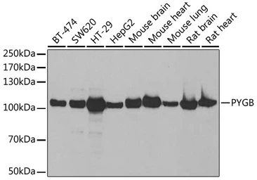 Anti-GPBB antibody used in Western Blot (WB). GTX64469