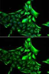 Anti-GPBB antibody used in Immunocytochemistry/ Immunofluorescence (ICC/IF). GTX64469