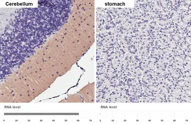 Anti-mGluR4 antibody [HL4697] used in IHC (Paraffin sections) (IHC-P). GTX644698