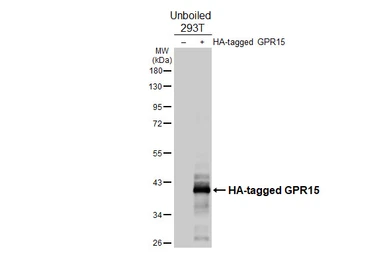 Anti-GPR15 antibody [HL4704] used in Western Blot (WB). GTX644705