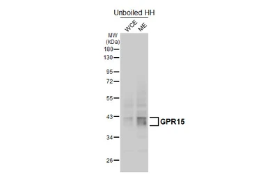 Anti-GPR15 antibody [HL4704] used in Western Blot (WB). GTX644705