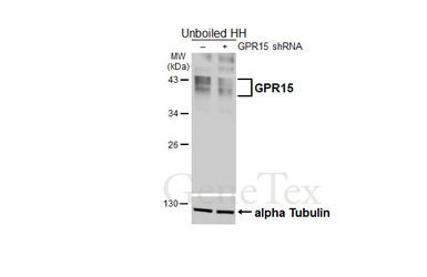 Anti-GPR15 antibody [HL4704] used in Western Blot (WB). GTX644705