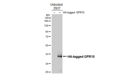 Anti-GPR15 antibody [HL4705] used in Western Blot (WB). GTX644706