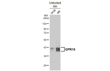 Anti-GPR15 antibody [HL4705] used in Western Blot (WB). GTX644706