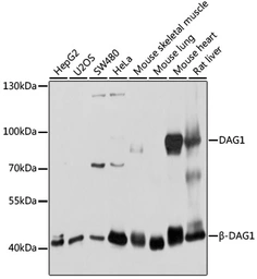 Anti-DAG1 antibody used in Western Blot (WB). GTX64471