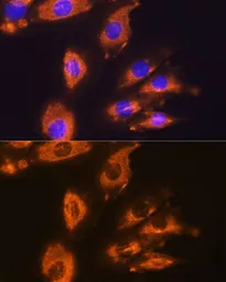 Anti-DAG1 antibody used in Immunocytochemistry/ Immunofluorescence (ICC/IF). GTX64471