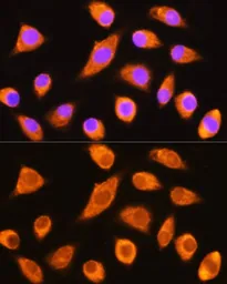 Anti-DAG1 antibody used in Immunocytochemistry/ Immunofluorescence (ICC/IF). GTX64471