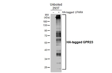 Anti-GPR23 antibody [HL4712] used in Western Blot (WB). GTX644713