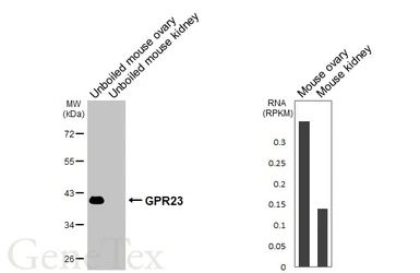 Anti-GPR23 antibody [HL4712] used in Western Blot (WB). GTX644713