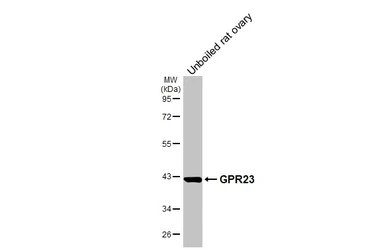 Anti-GPR23 antibody [HL4712] used in Western Blot (WB). GTX644713