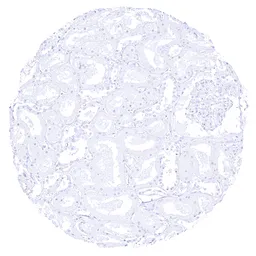 Anti-BSEP antibody [HMV4715] HistoMAX&trade; used in IHC (Paraffin sections) (IHC-P). GTX644716
