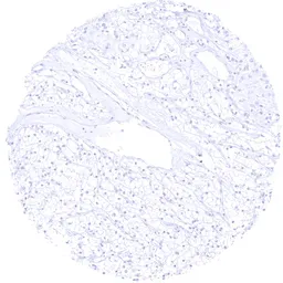 Anti-Opsin Red / Green antibody [HMV4716] HistoMAX&trade; used in IHC (Paraffin sections) (IHC-P). GTX644717