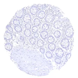 Anti-Opsin Red / Green antibody [HMV4716] HistoMAX&trade; used in IHC (Paraffin sections) (IHC-P). GTX644717