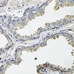 Anti-Aconitase 1 antibody used in IHC (Paraffin sections) (IHC-P). GTX64472
