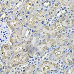 Anti-Aconitase 1 antibody used in IHC (Paraffin sections) (IHC-P). GTX64472