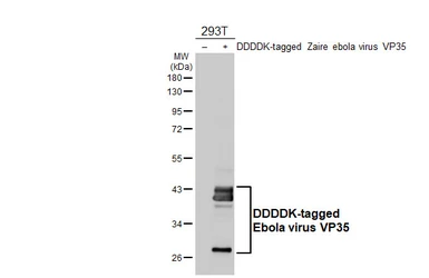 Anti-Ebola virus VP35 antibody [HL4726] used in Western Blot (WB). GTX644730