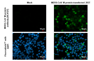 Anti-MERS-CoV M protein antibody [HL4727] used in Immunocytochemistry/ Immunofluorescence (ICC/IF). GTX644731