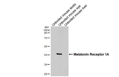 Anti-Melatonin Receptor 1A antibody [HL4732] used in Western Blot (WB). GTX644736