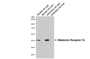 Anti-Melatonin Receptor 1A antibody [HL4732] used in Western Blot (WB). GTX644736