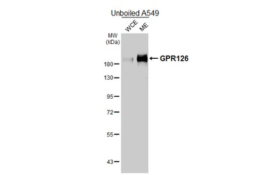 Anti-GPR126 antibody [HL4744] used in Western Blot (WB). GTX644748