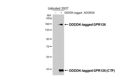 Anti-GPR126 antibody [HL4744] used in Western Blot (WB). GTX644748