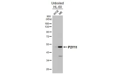 Anti-P2Y11 antibody [HL4748] used in Western Blot (WB). GTX644752