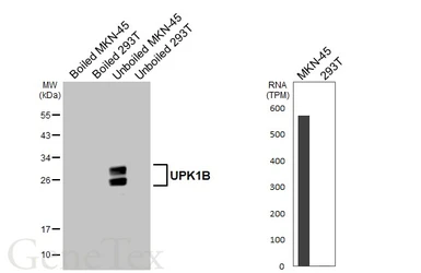 Anti-UPK1B antibody [HL4754] used in Western Blot (WB). GTX644758