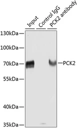 Anti-PCK2 antibody used in Immunoprecipitation (IP). GTX64476