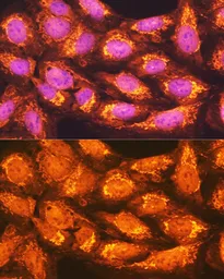Anti-PCK2 antibody used in Immunocytochemistry/ Immunofluorescence (ICC/IF). GTX64476
